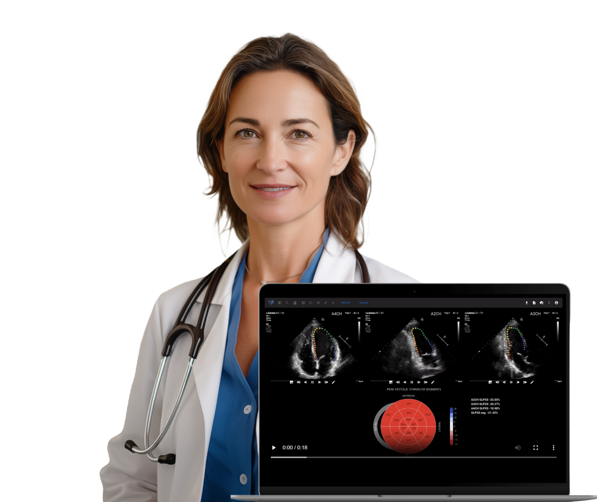 Ligence echocardiography reporting software ai